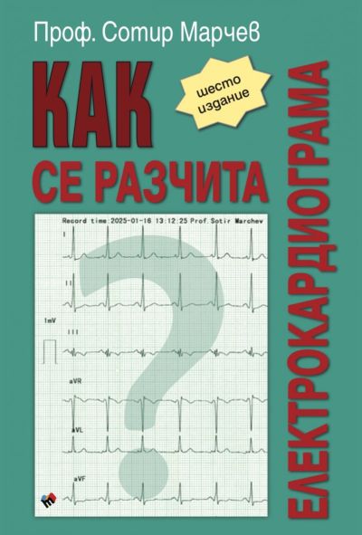 КАК се разчита електрокардиограма