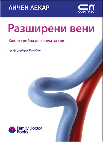Разширени вени